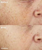 SkinMedica- LUMIVIVE System before and after