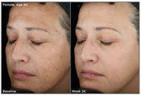 SkinMedica Dermal Repair Cream before and after