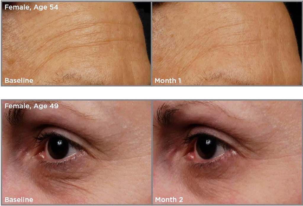 SkinMedica® TNS Essential Serum before and after