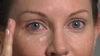 SkinMedica's TNS Eye Repair how to use