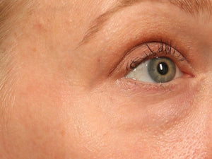 SkinMedica- TNS Eye Repair-The Skin Spot