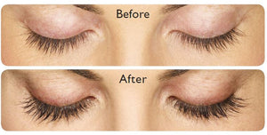 Allergan- Latisse-The Skin Spot