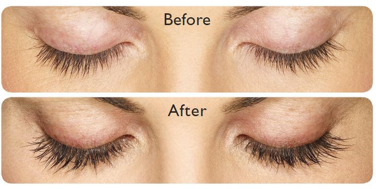 Allergan- Latisse-The Skin Spot