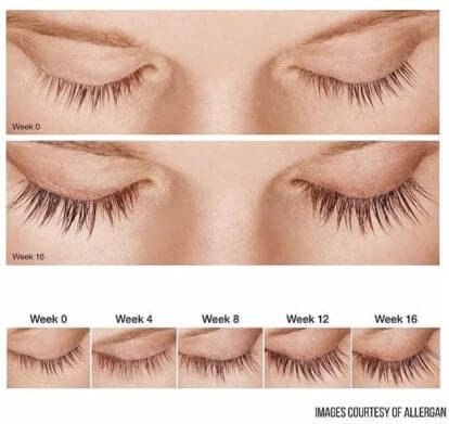 Allergan- Latisse-The Skin Spot