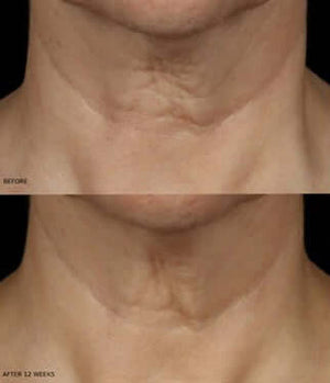 Revision Skincare- Nectifirm Advanced-The Skin Spot