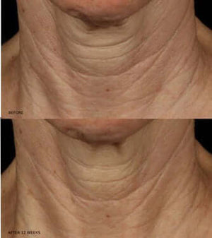 Revision Skincare- Nectifirm Advanced-The Skin Spot