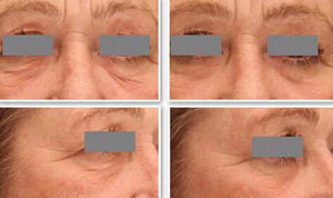 DefenAge 3D Eye Radiance Cream before and after grid shows eye area wrinkles, puffiness and smoother-looking under eye skin.