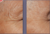 defenage 8-in-1 bioserum before and after