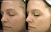 iS Clinical- Brightening Complex  before and after]