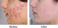  iS CLINICAL Pro-Heal Serum before and after
