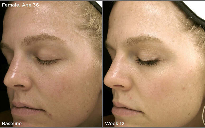iS Clinical- Brightening Complex (a.k.a. White Lightening Complex)-The Skin Spot