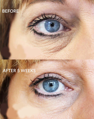 iS Clinical Youth Eye Complex before and after 5 weeks eye image shows under eye wrinkles and smoother-looking skin care use
