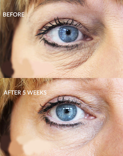 Before and after 5 weeks using iS Clinical Youth Eye Complex, showing reduced wrinkles and improved eye contour