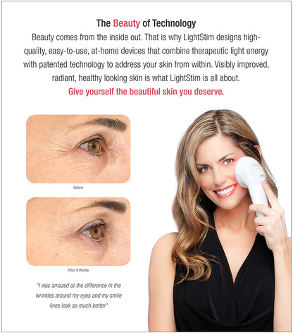 Promotional image for LightStim for Wrinkles showing before and after eye treatment results over 8 weeks