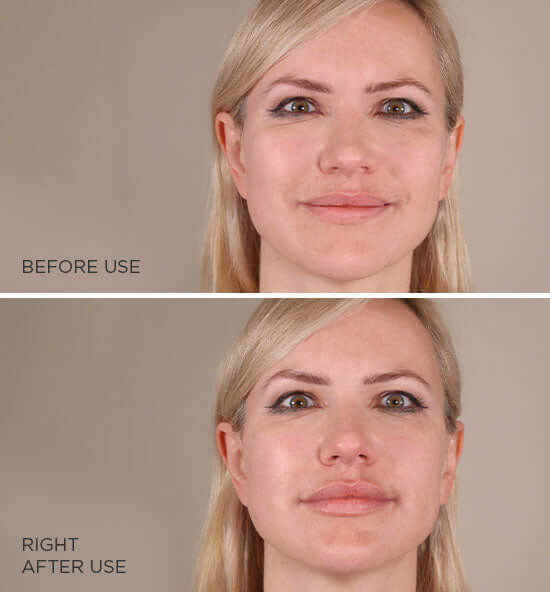 MesoLyft Lips lip replenisher before and right after use showing visibly fuller smoother hydrated lips
