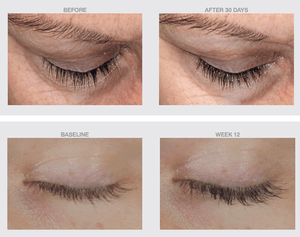 FREE NazarianSkin Lash Boost Serum!-The Skin Spot