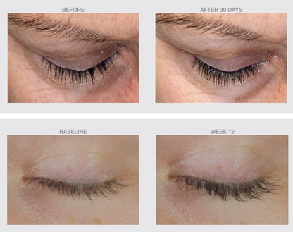 Before and after 12 weeks and 30 days using Nazarian Skin Lash Serum, showing enhanced lash fullness and length