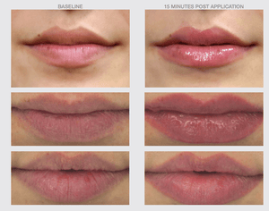 Lip Boost SPF30 Plumping Hydrating Serum-The Skin Spot