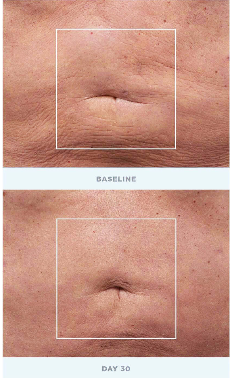 NuFACE- NuBODY Toning & Firming Kit-The Skin Spot