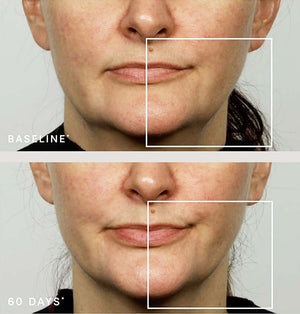 NuFACE- Effective Lip and Eye (ELE) Attachment (Non-Refundable)-The Skin Spot