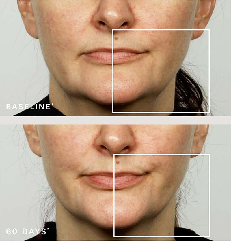 NuFACE- Effective Lip and Eye (ELE) Attachment (Non-Refundable)-The Skin Spot