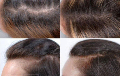 Nutrafol Hair Growth Serum before and after grid shows fuller-looking part lines and improved scalp coverage over time now..