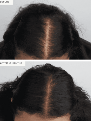 Nutrafol- Women's Balance-The Skin Spot