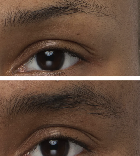 Obagi NuCIL Brow Boosting Serum results showing enhanced eyebrow fullness and definition after use