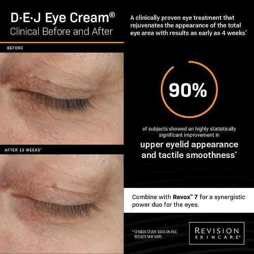 Revision Skincare D·E·J Eye Cream clinical before and after study showing improved upper eyelid smoothness after 12 weeks