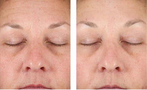 Before and after facial firmness comparison following use of Revision Skincare DEJ Night Face Cream firming night cream