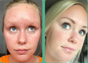 Revision Skincare- Gentle Cleansing Lotion-The Skin Spot