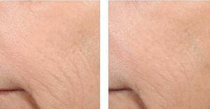 Revision Skincare- Retinol Complete 1.0-The Skin Spot