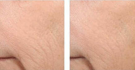 Revision Skincare- Retinol Complete 1.0-The Skin Spot