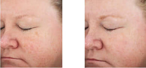 Revision Skincare- Retinol Complete 1.0-The Skin Spot
