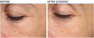 Revision Skincare- Revox Line Relaxer-The Skin Spot