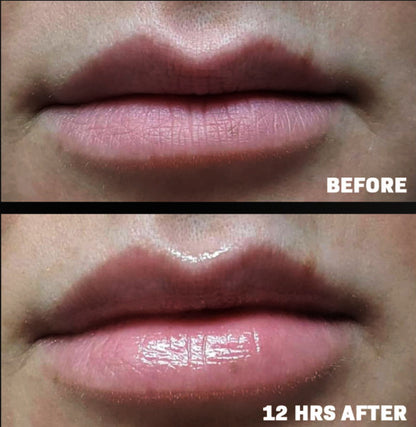 Before and after 12 hours using Revision Skincare YouthFull Lip Replenisher, showing enhanced lip hydration and visible plumping