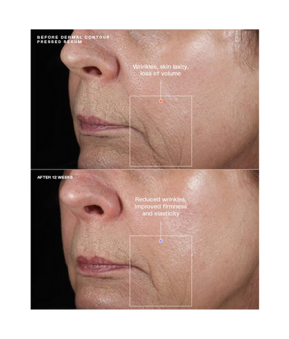 Before and after using SENTÉ Dermal Contour Pressed Serum, 12-week results showing reduced wrinkles and improved skin