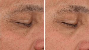 Sente- Illumine Eye Cream-The Skin Spot