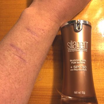Arm scar shown beside Silagen silicone scar gel with SPF 30 (15g) bottle on wooden surface for scar protection.