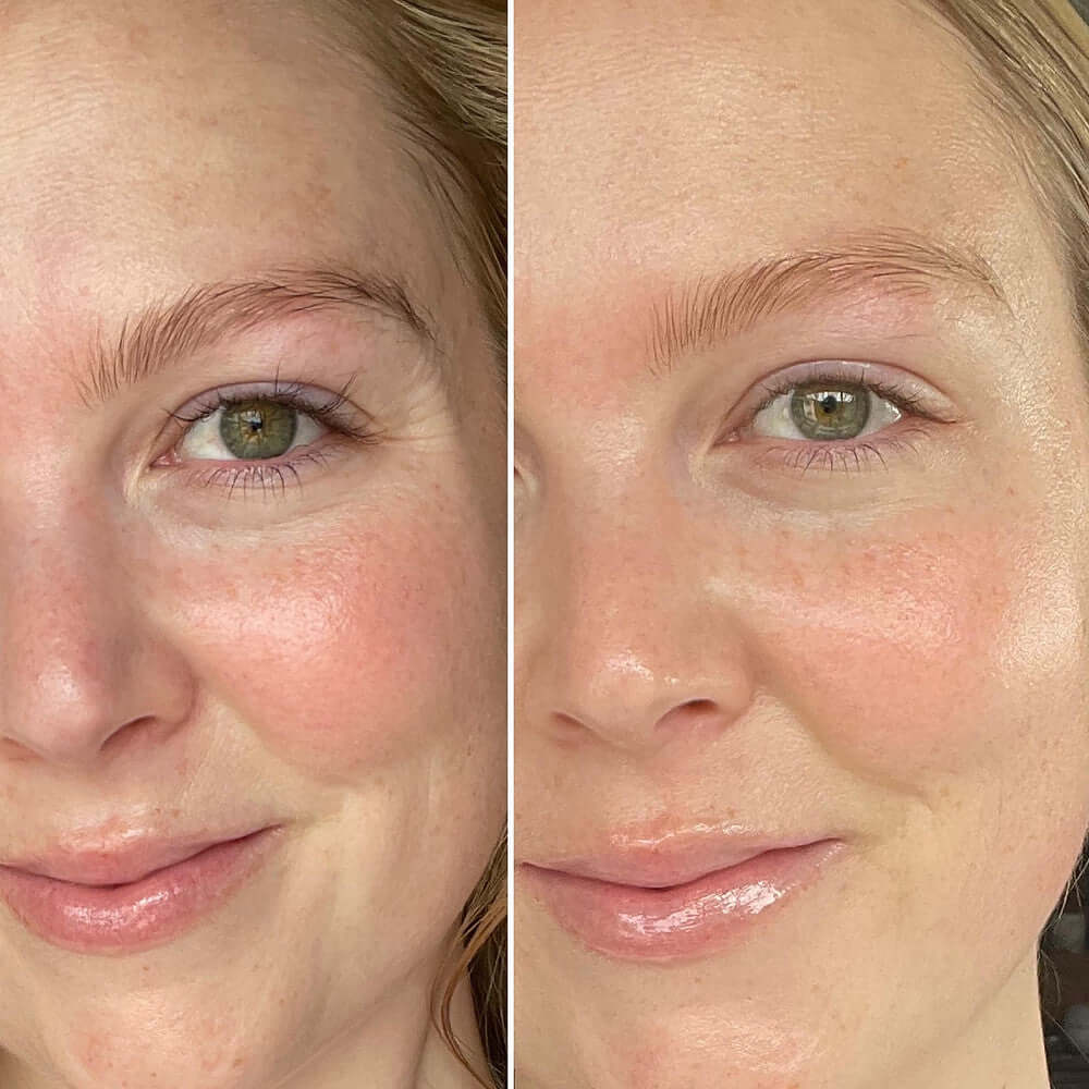 Before and after photo showing brighter, smoother skin from using SkinCeuticals C E Ferulic vitamin C serum for anti-aging