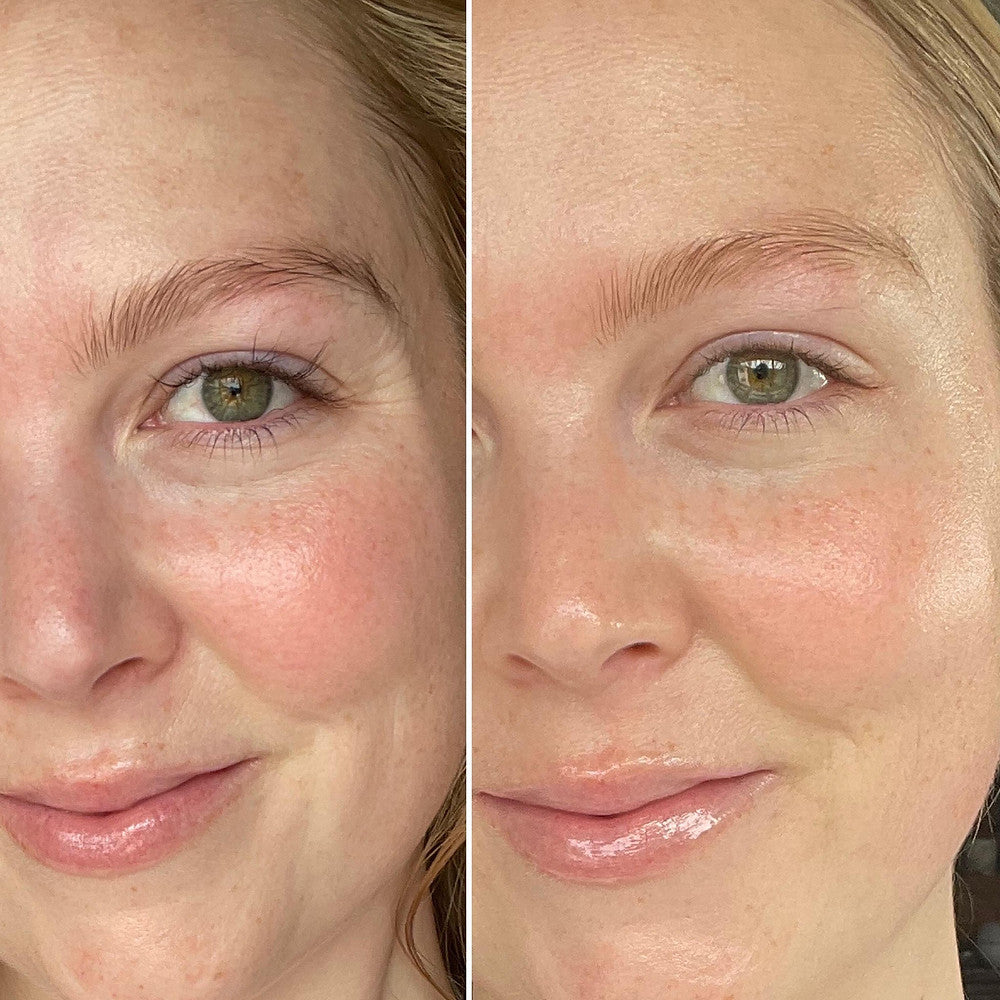 Before and after using SkinCeuticals C E Ferulic, showing brighter skin tone, reduced redness, and a smoother complexion