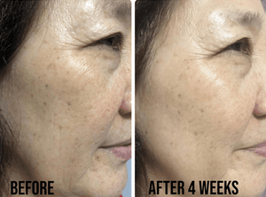 Before and after 4 weeks using SkinCeuticals Glycolic 10 Renew Overnight, showing smoother, brighter skin texture.
