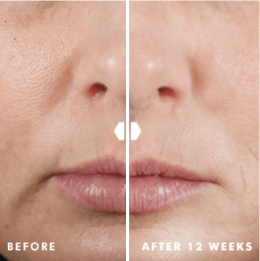 SkinCeuticals- Hyaluronic Acid Intensifier (H.A.) Multi Glycan-The Skin Spot
