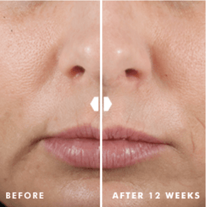 SkinCeuticals- Hydrating B5 Gel-The Skin Spot