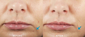 SkinCeuticals- Hydrating B5 Gel-The Skin Spot