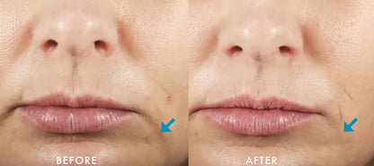 Before and after results of using SkinCeuticals Hydrating B5 Gel, showing smoother, plumper, and more hydrated skin