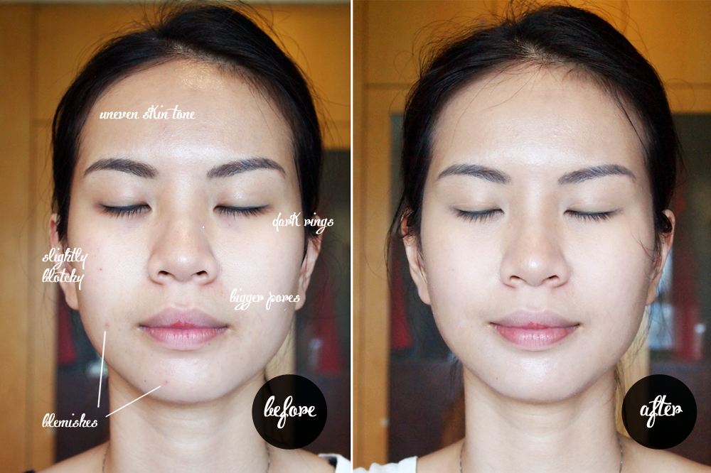 Before and after using SkinCeuticals Physical Fusion UV Defense SPF 50, showing improved skin tone and reduced blemishes