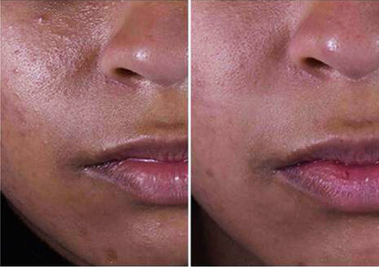 Before and after results of using SkinCeuticals Silymarin CF, showing reduced oiliness and improved texture