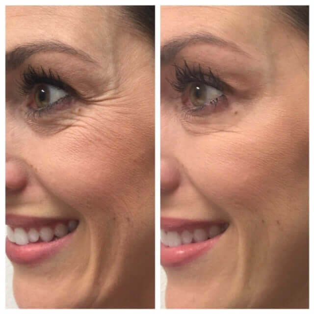 SkinMedica- Dermal Repair Cream-The Skin Spot