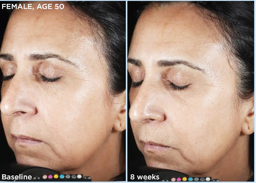 Before and after of SkinMedica HA5 Rejuvenating Hydrator showing improved hydration and skin smoothness after 8 weeks of use